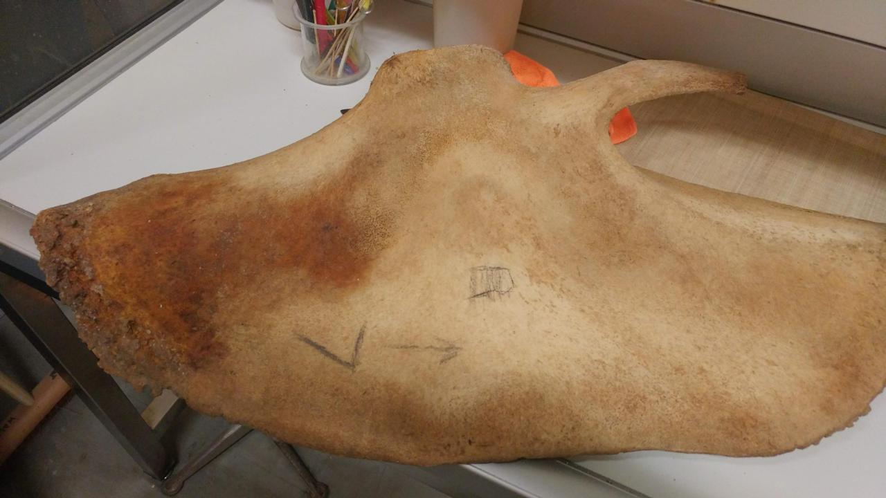 Schouderblad met arthritis